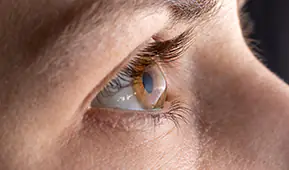 Keratoconus Treatment