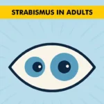 Strabismus in Adults When Squint Develops Later in Life